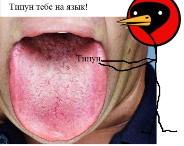 Как избавиться от типуна в домашних условиях Как избавиться от типуна в домашних условиях