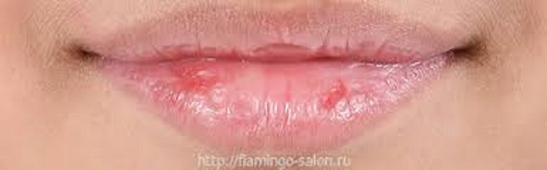 Анекдот про руль и дурака Анекдот про руль и дурака
