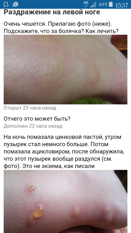 Лифтинг лица - подтяжка кожи лица Курсы шитья в Иркутске - Азбука шитья