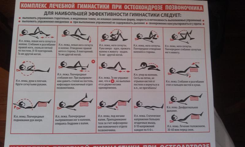 Почему важно своевременно лечить остеохондроз