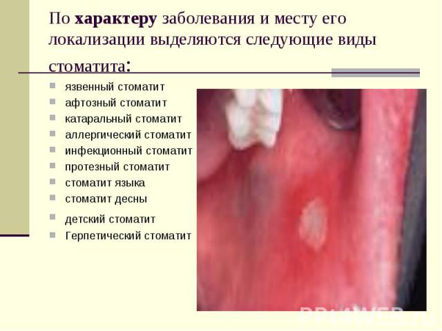 Большие члены трансов - подборка 008 Еще порно фото
