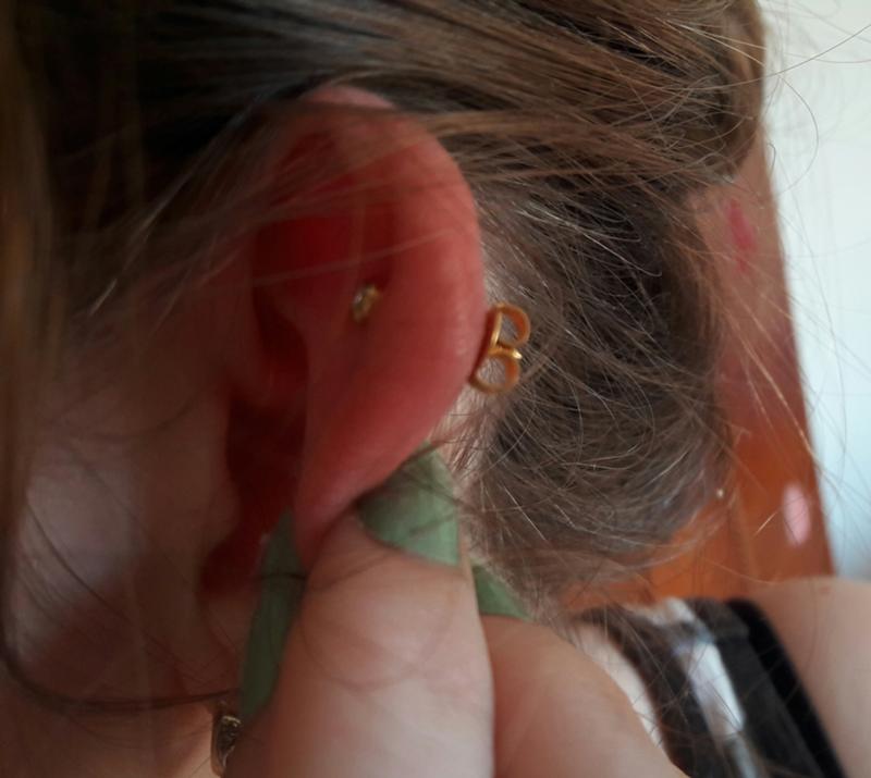 Что сделать чтобы не болело ухо в домашних условиях 876