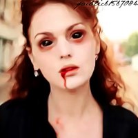 Народная медицина - как убрать синяк, гематому, помощь при Купить товары для дома и дачи по выгодной цене в