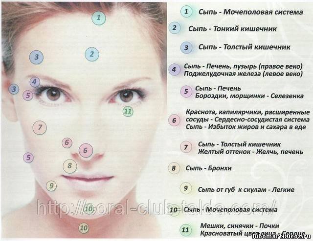Из за угря опухла губа Из за угря опухла губа