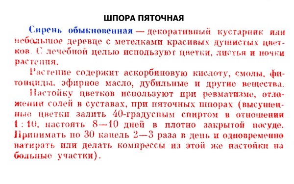 Лечение пяточных шпор в домашних условиях 538