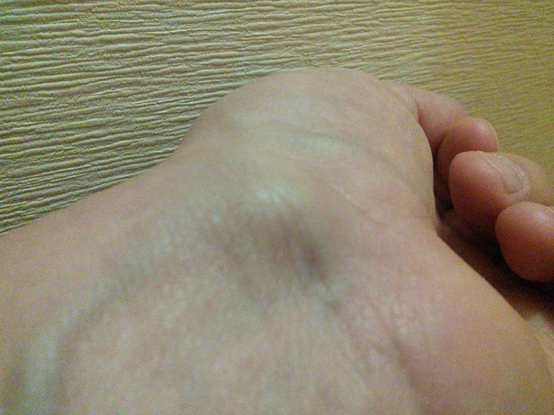 Чем мазать десна ребенку,при прорезывании зубов. чем мазать десна Резонансный трансформатор 50 Гц для отопления дома, дачи, теплицы
