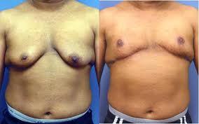 female to male sex change pics 322456 female to male sex change pics 322455