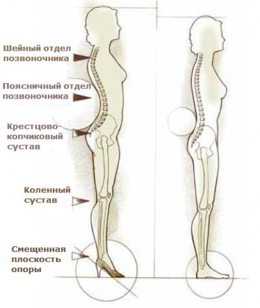 Болят суставы от каблуков Болят суставы от каблуков