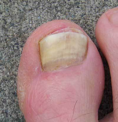 164