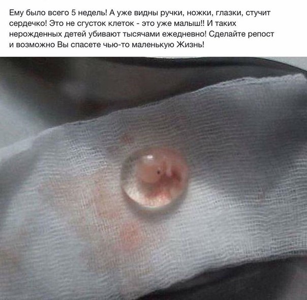 Беременная отдалась за деньги 15