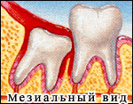 Если делать массаж живота жир уйдёт Если делать массаж живота жир уйдёт