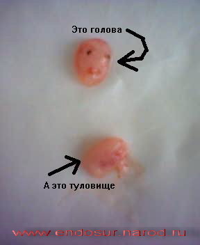 Глазная боль на Гинекология в Перми: консультация и осмотр гинеколога