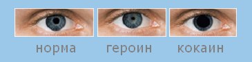 Почему у меня расширенные зрачки Почему у меня расширенные зрачки