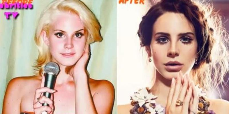 Lana del rey до и после пластики Lana del rey до и после пластики