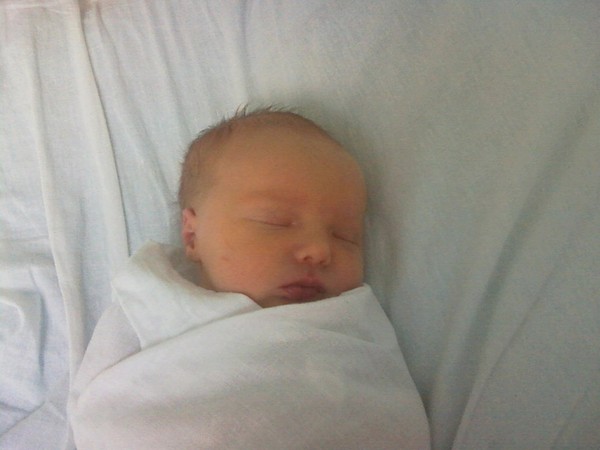 близняшки только родились. лысые новорожденные дети. альбинизм у новорожденных.