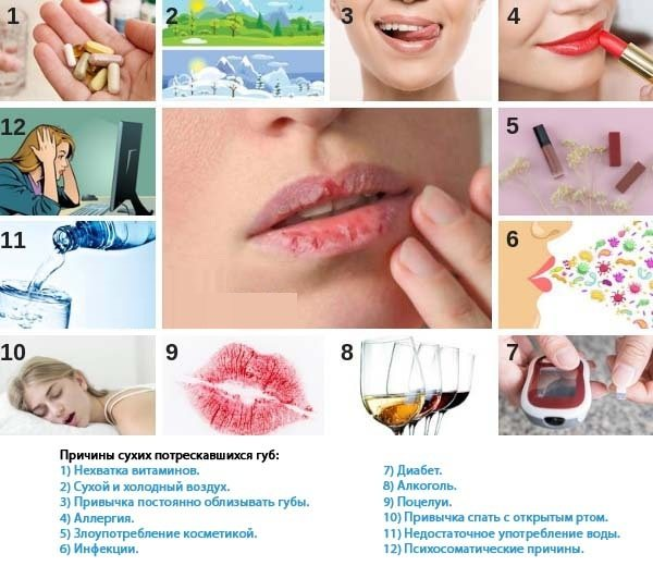 Сохнут губы, что делать? | Ответы Mail