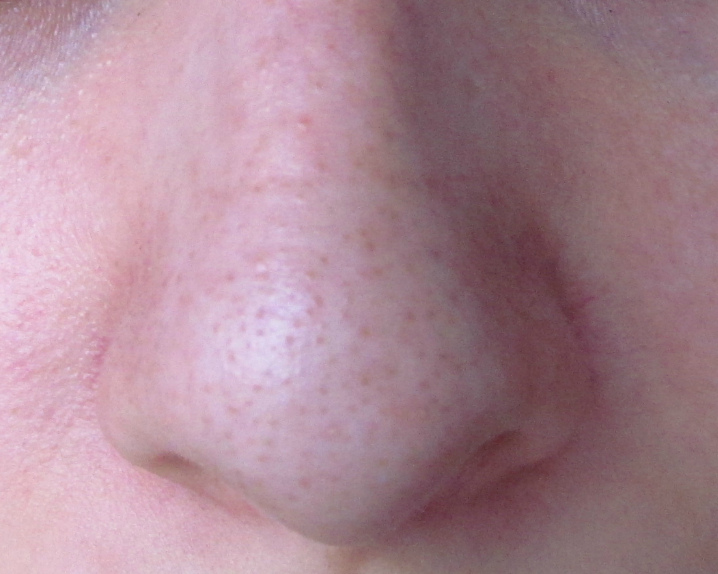 Пластинки для удаления чёрных точек купить лучшие товары в интернет-магазине C