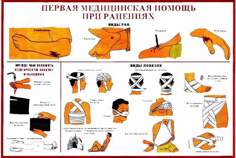 Оказание первой помощи при осколочном ранении. Оказание первой медицинской помощи перевязки. первая помощь при ранениях. первая медицинская помош ь при ранении.