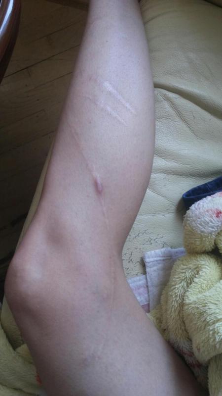 можно ли избавиться от паразитов народными средствами можно ли избавиться от паразитов народными средствами