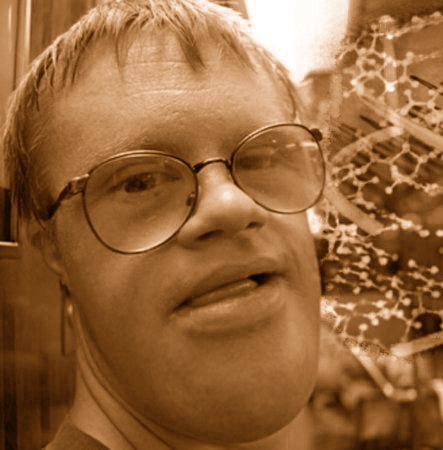 отсталые парни. умственно-отсталый человек. олигофрен фото. инвалид аутист. умственно отсталые мужчины.