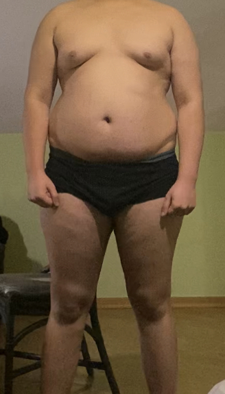 Әйелдер кискалары