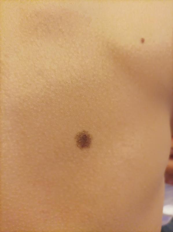 что означают родинки на лице у женщин. родинки на плечах значение. родинки на руках значение у женщин. родинки на плечах значение. что означает родимоепетно.