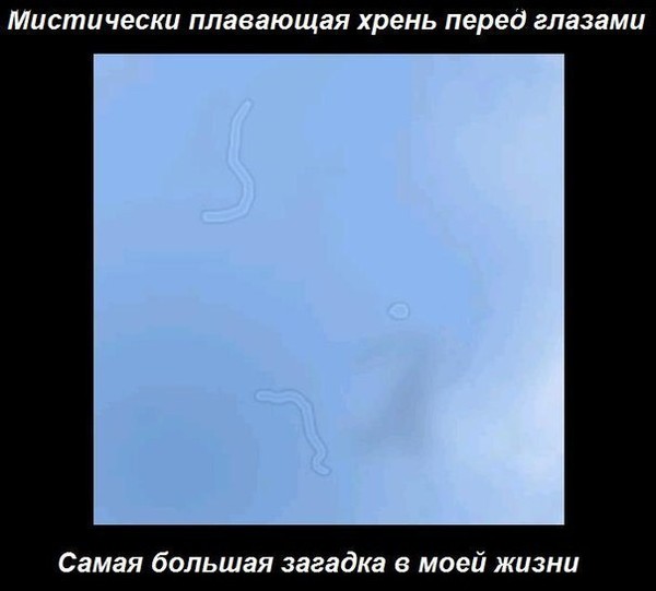резкая картинка перед глазами боня последнее время