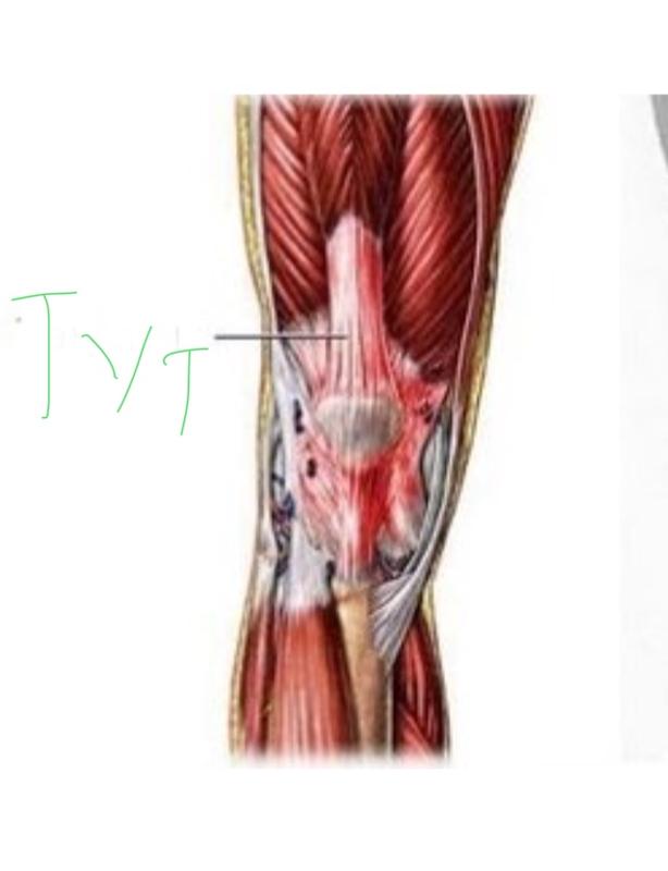 Растяжение ахиллова сухожилия. Тендовагинит сухожилия двуглавой мышцы. Растяжение ахиллесового сухожилия. Утолщенное сухожилие. Тендиноз ахиллесова сухожилия.