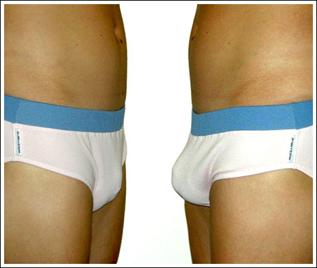 How to increase the size of the penis in 16 years How to increase the size of the penis in 16 years