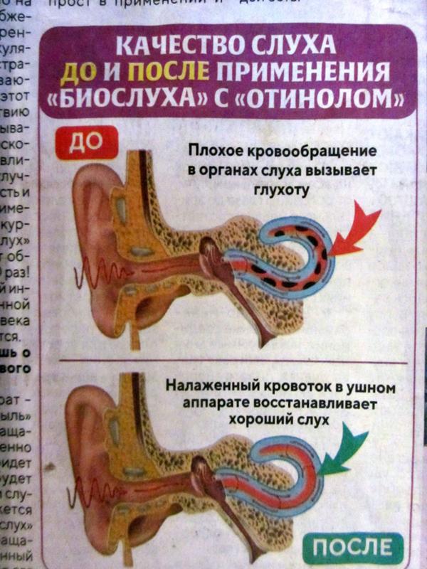 Ответы Mail: Как вам устройство уха из газеты "Секреты здоровья"? Капли ...