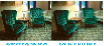 Ухудшение зрения при линзе