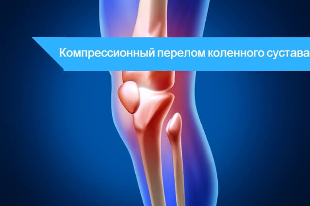 Компрессионный перелом колена. Импрессионный перелом мыщелков большеберцовой кости. Перелом мыщелка коленного сустава. Компрессионный перелом колена. Внутрисуставной перелом коленного сустава.